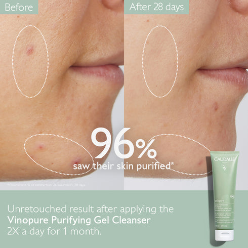 Vinopure Purifying Gel Cleanser